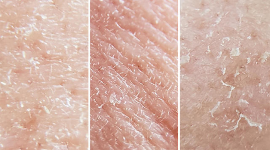 skin-issues-checks-dermascope