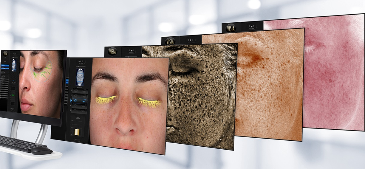 skin-analyzers-and-beauty-machines