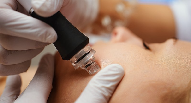 hydrodermabrasion_facial