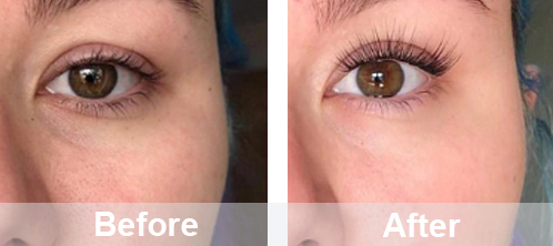 The_benefits_of_using_smart_skin-analyzers_and_hydrodermabrasion