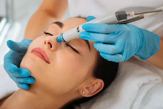 Hydrodermabrasion_benefits
