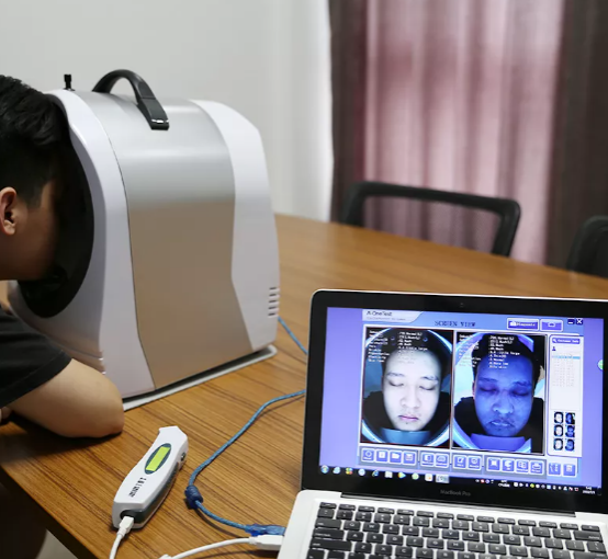 ai_skin_analyzer_in_beauty_salons 