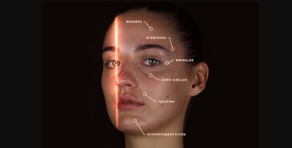 skin_analysis