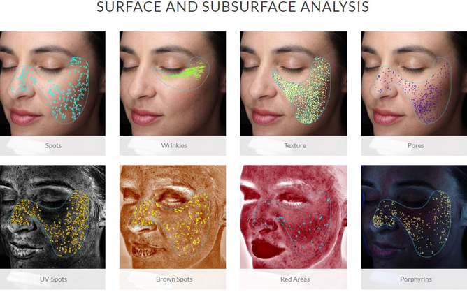  visia-skin-analysis-equipment