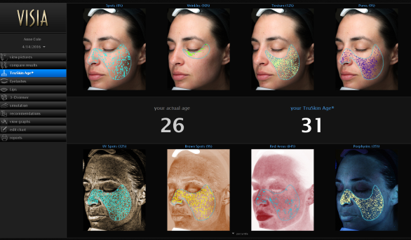 visia skin analysis device