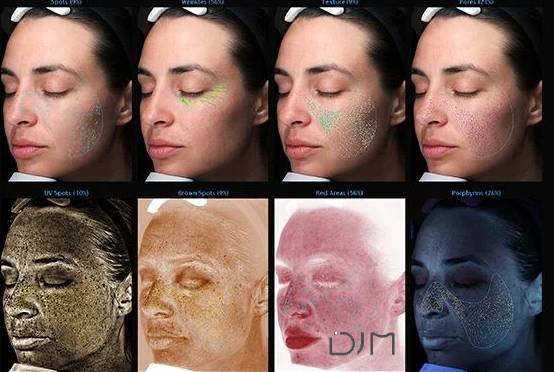 Skin Analyzer,i MoreMe, DJM