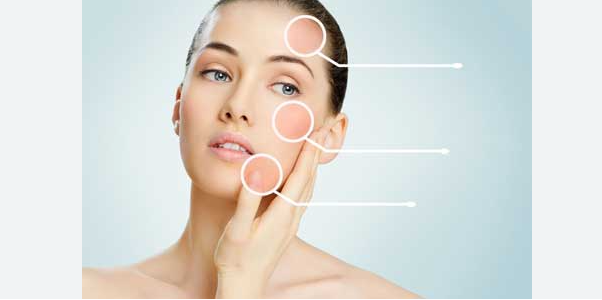 face skin analysis