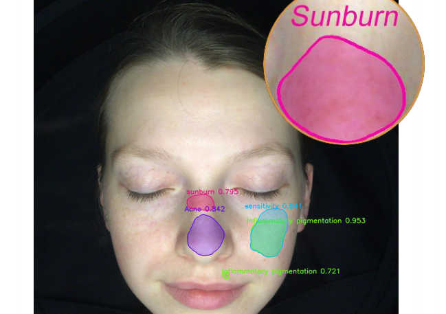skin analysis machine