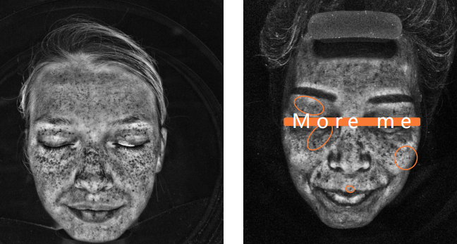 Skin Analyzer,i MoreMe, DJM