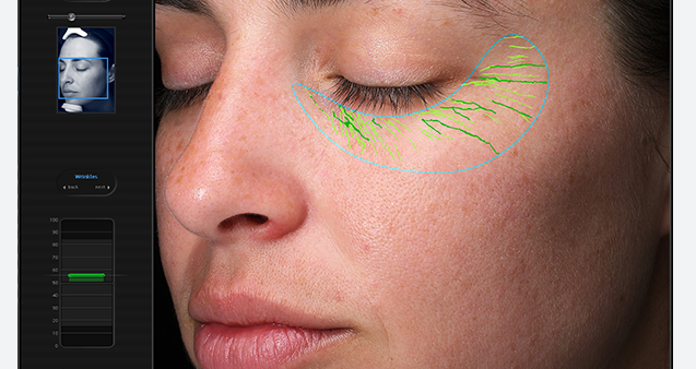 skin analysis