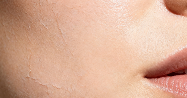 Skin Analyzer,i MoreMe, DJM