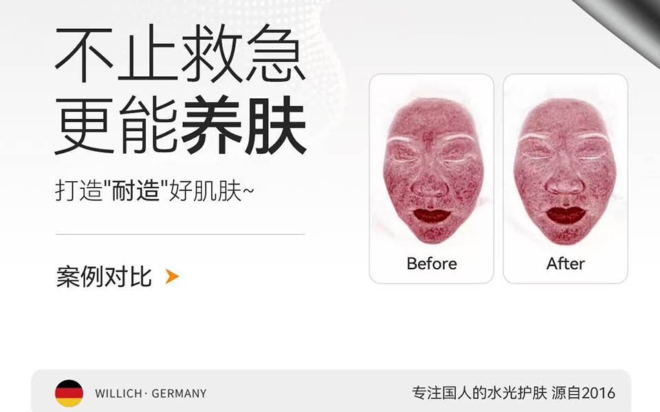 Hydroglow Facial Machine