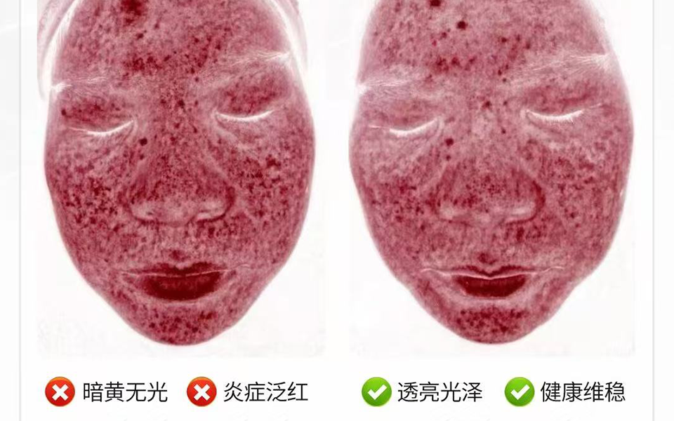 Imoreme Hydroglow Facial Machine