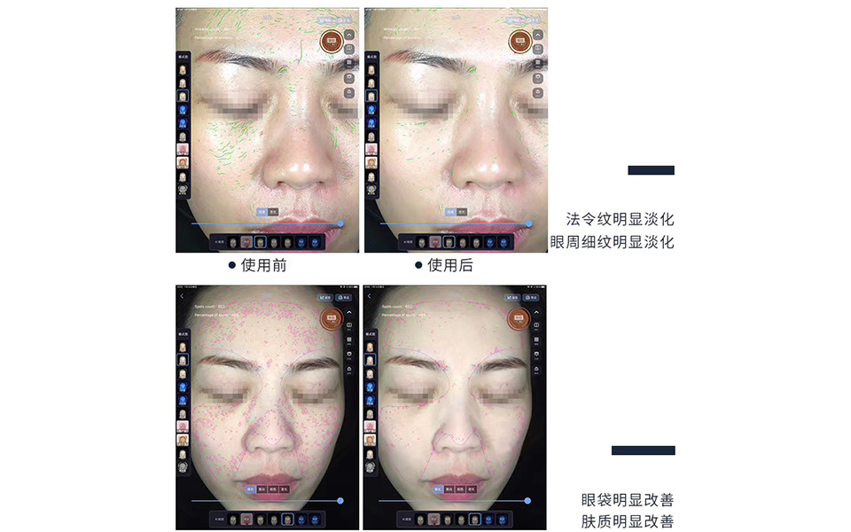 Radio Frequency Devices