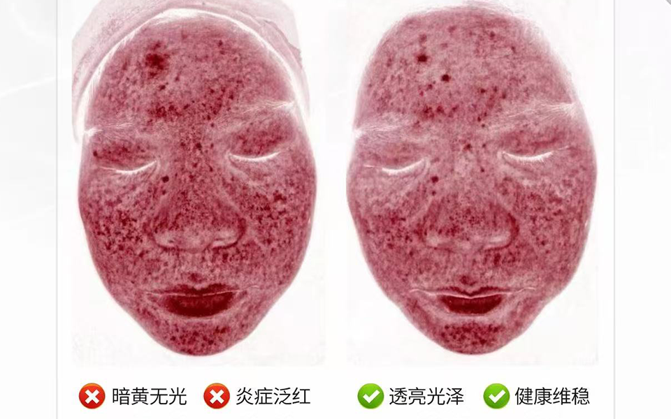 Imoreme Hydroglow Facial Machine