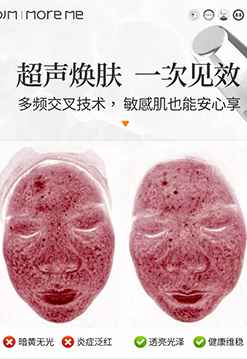 hydroglow at-home facial machine